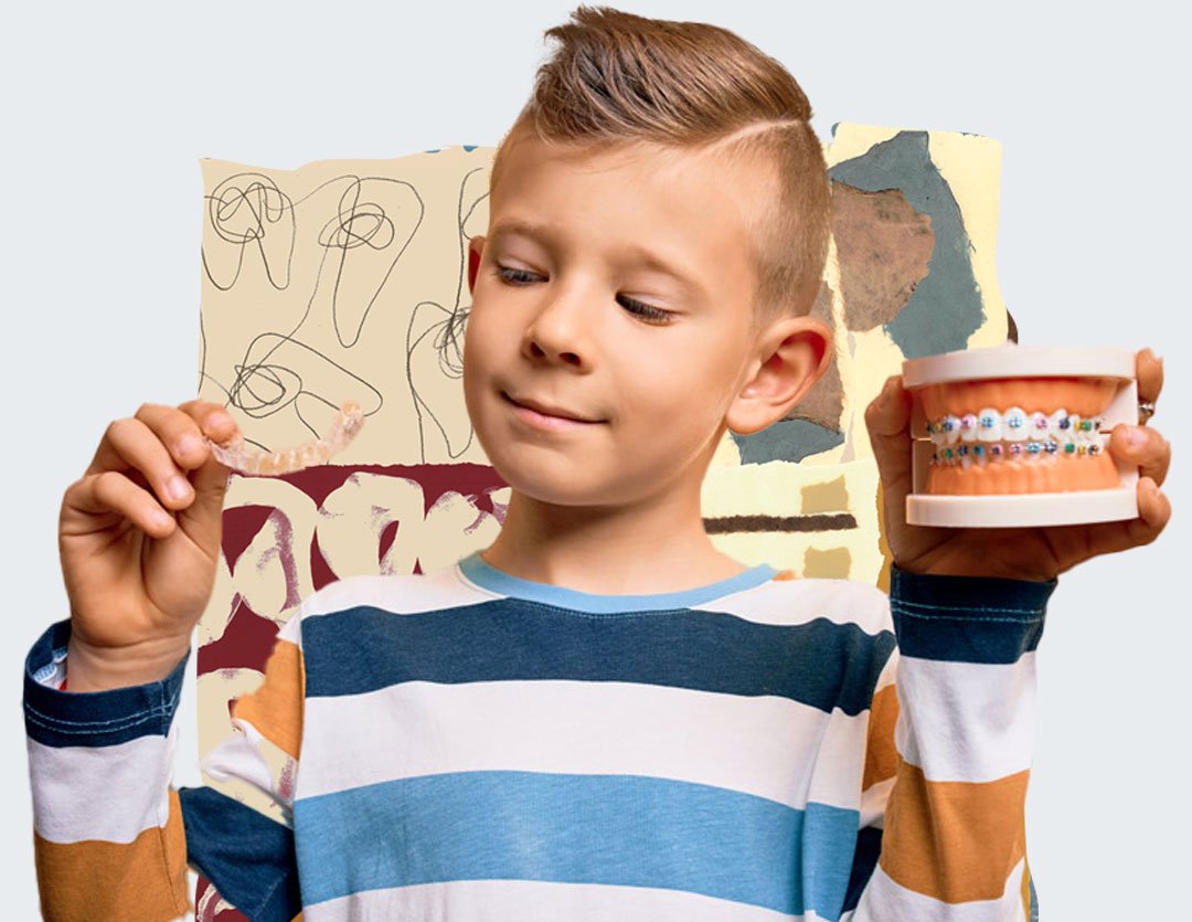 ortodoncia invisible para niños, invisalign first