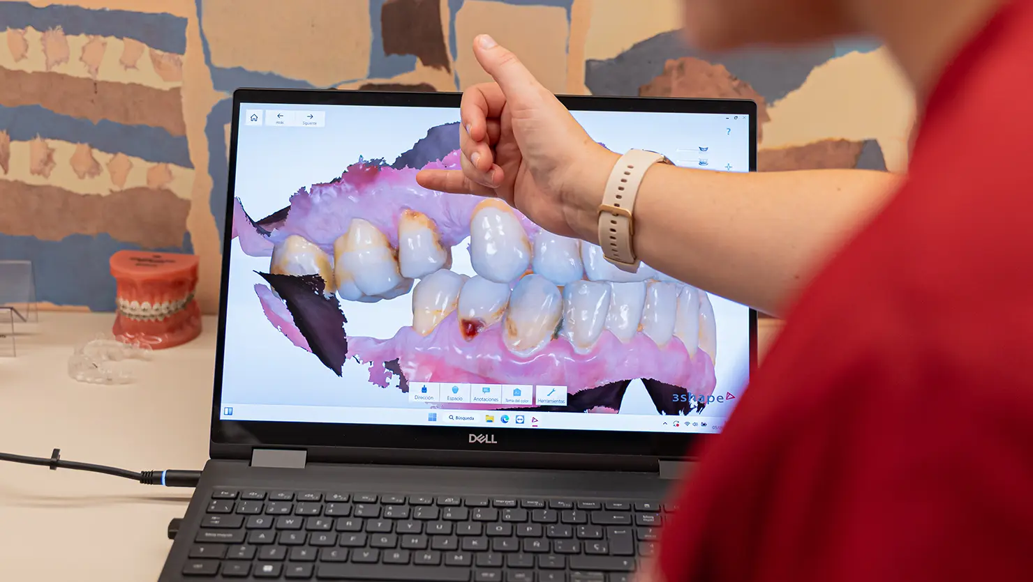 Planificación de tratamiento de implantes dentales en Santiago de Compostela