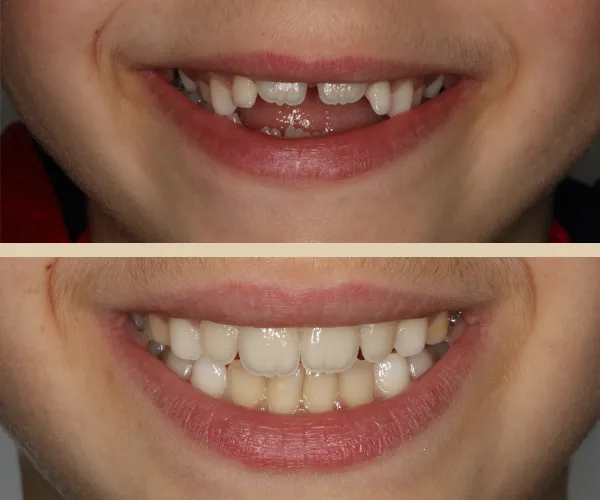 caso sergio l facial frontal