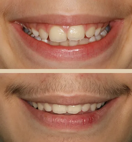 caso xose frontal facial